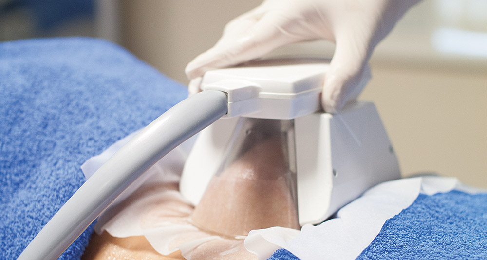 How Fat Freezing and HIFU Work Together? 2 Multiple Areas in One Session HIFU and Fat Freezing Haverhill