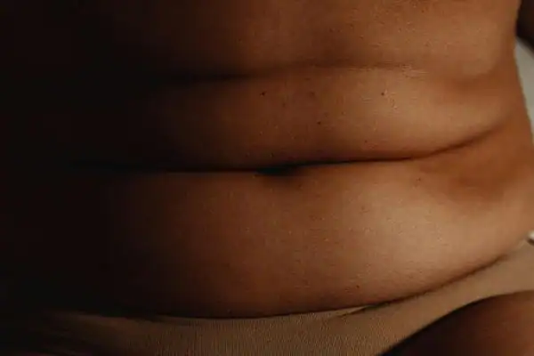 The Hidden Connection: How Stress Shapes Your Fitness and Body Composition 3 image of what stress can do on the stomach area and how Lipo 360 Haverhill can help to change your body shape.